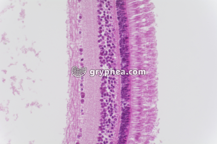 Rétine sans choroïde x40 - gryphea.org